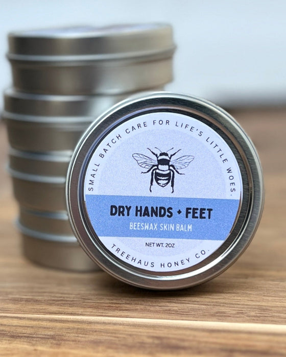 Dry Hands & Feet Skin Balm